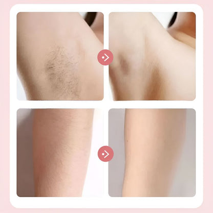 VelvetShave™ | Voor een Zijdezachte en Irritatievrije Huid